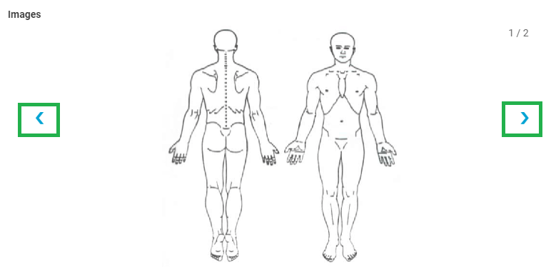 BodyMapImage3.PNG