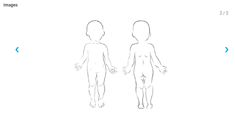 BodyMapImage5.PNG